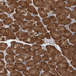 Anti-ALAD antibody produced in rabbit 