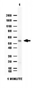 Anti-Aldehyde dehydrogenase 1 (ALDH1A1) Antibody 
