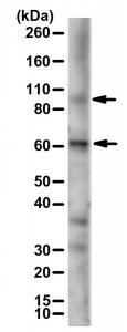 Anti-AML1-ETO 