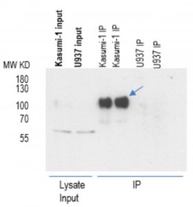 Anti-AML1-ETO 