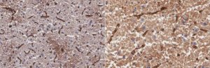Anti-Aquaporin-4 Antibody, clone mECD 