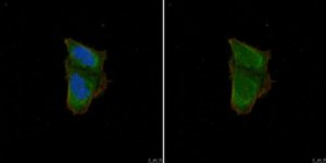 Anti-Calcipressin-1 