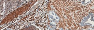Anti-Calponin Antibody, clone CALP 