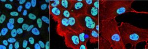 Anti-CCAR1 Antibody, clone 4B9.1 