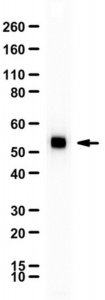 Anti-Chitinase-1 (CHIT1) 
