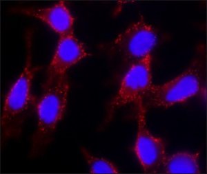 Anti-Cholera toxin, B Subunit (CTxB) antibody, Mouse monoclonal 