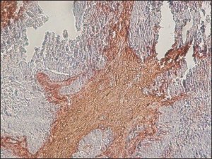 Anti-Chondroitin Sulfate antibody, Mouse monoclonal 
