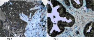 Anti-Claudin-5 Antibody 