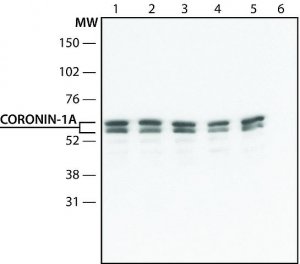 Anti-Coronin-1C (C-terminal) 