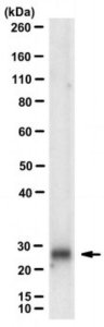 Anti-Cyclin D2 Antibody, clone D2-34B1-3 