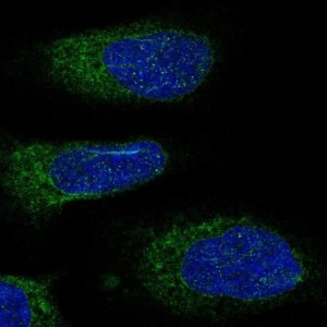 Anti-DDOST antibody produced in rabbit 