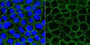 Anti-Desmoglein 2 Antibody, clone 6D8 