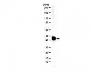 Anti-Ferrochelatase 
