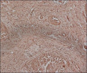 Anti-Fetuin A antibody, Mouse monoclonal 