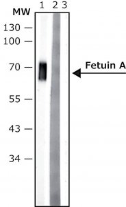 Anti-Fetuin A antibody, Mouse monoclonal 