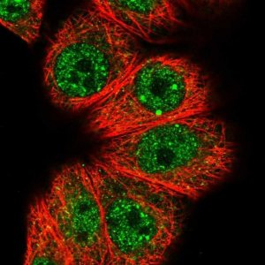 Anti-HOXB7 antibody produced in rabbit 