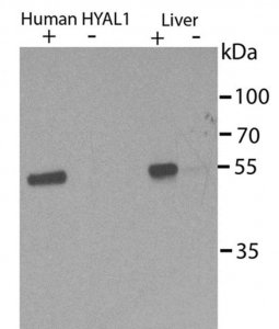 Anti-HYAL1 Antibody, clone 1D10 
