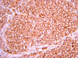 Anti-Hypoxia Inducible Factor 1 Antibody, clone H167 