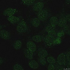 Anti-Lamin B Receptor (LBR) Antibody, clone BB2SS3F3 