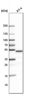 Anti-LCOR antibody produced in rabbit 