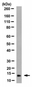 Anti-Microglobulin beta2 Antibody, clone BBM.1 