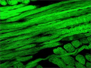 Anti-Myosin (Skeletal, Fast) antibody, Mouse monoclonal 