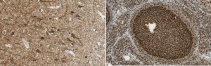 Anti-Neurofilament NF-H Antibody, phosphorylated Antibody, clone NP1 