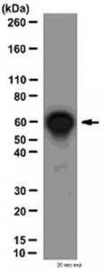 Anti-NFB p65 Antibody, CT 