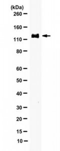 Anti-phospho-MDA-5 (Ser104) 