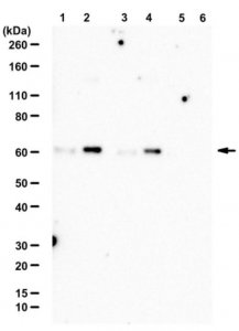 Anti-phospho-SIN1 (Thr86) 