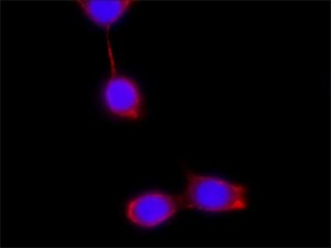 Anti-Podocin, Mouse monoclonal 