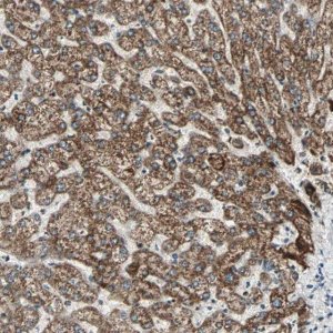 Anti-PRELID1 antibody produced in rabbit 