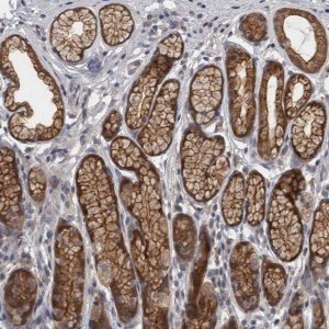 Anti-PRKCI antibody produced in rabbit 