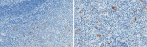 Anti-Properdin Antibody, clone 3A3E1 