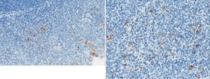 Anti-Properdin Antibody, clone 6E11A4 