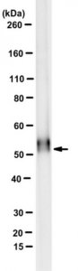 Anti-Properdin Antibody, clone 6E11A4 