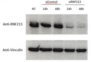 Anti-Ring Finger Protein 213 (RNF213) 