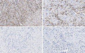 Anti-sACDY10 Antibody, clone R21 
