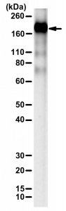 Anti-SARS-CoV-2 spike protein ectodomain (S1+S2) 