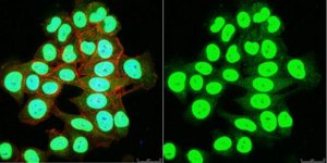 Anti-SNF2/BRG1 Antibody 