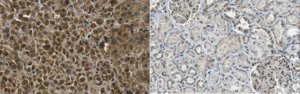 Anti-SREBP-1 
