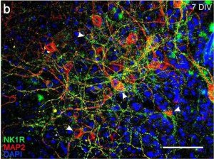 Anti-Substance P Receptor antibody produced in rabbit 