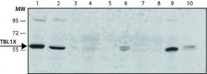 Anti-TBL1X antibody, Mouse monoclonal 