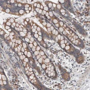 Anti-TMEM199 antibody produced in rabbit 