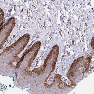 Anti-TRIM55 antibody produced in rabbit 