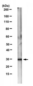 Anti-Tropomyosin-1 Antibody, clone 7F8B8 
