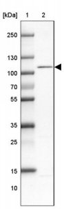 Anti-WBP11 antibody produced in rabbit 