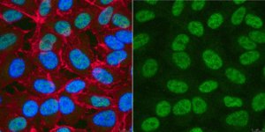 Anti-XPD Antibody, clone 22TF2-2F6 