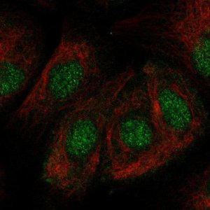 Anti-ZNF319 antibody produced in rabbit 