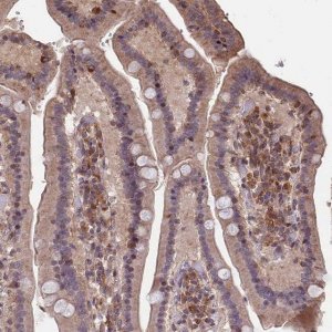 Anti-ZNF598 antibody produced in rabbit 